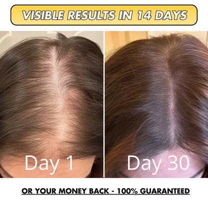 Velyra™ Natural Hair Boost