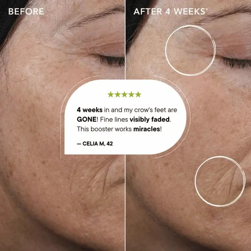 Velyra™ Retinal | Tightening Booster