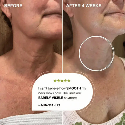 Velyra™ Retinal | Tightening Booster